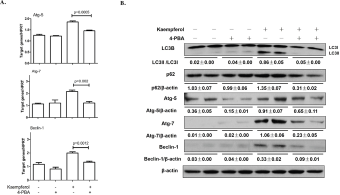 Endoplasmic reticulum stress inhibition by 4-PBA alleviates kaempferol-induced autophagy in HepG2 cells.