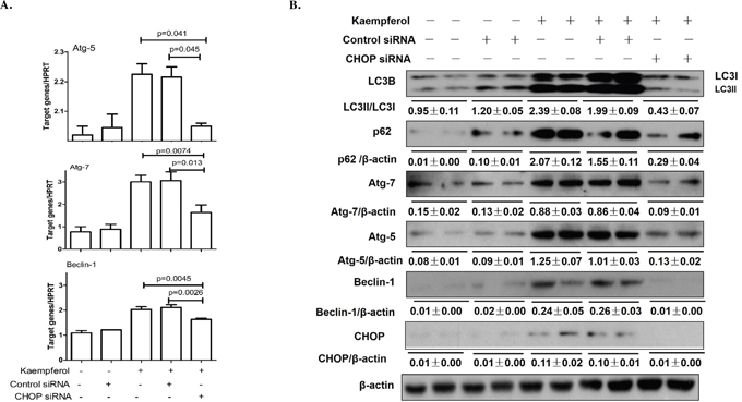 Knockdown of CHOP with siRNA remits kaempferol-induced autophagy.