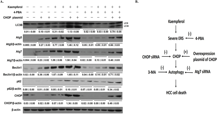 Transfection with CHOP-overexpression plasmid reverses the effect of 4-PBA on kaempferol-induced HepG2 cell autophagy.