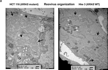 Figure 4a: Transmission electron micrograph of HCT116 and Hke3 cells upon 5MOI reovirus treatment for 48 hours.