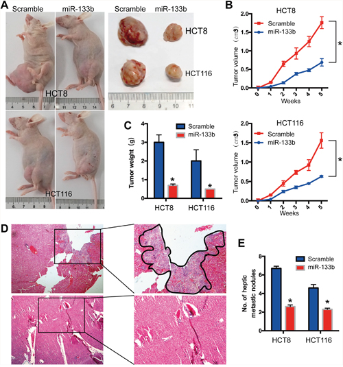 MiR-133b suppresses CRC tumorigenesis and metastasis in vivo.