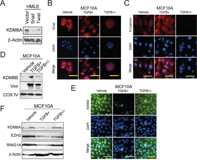 KDM6A protein levels are decreased following EMT and upregulated during MET.
