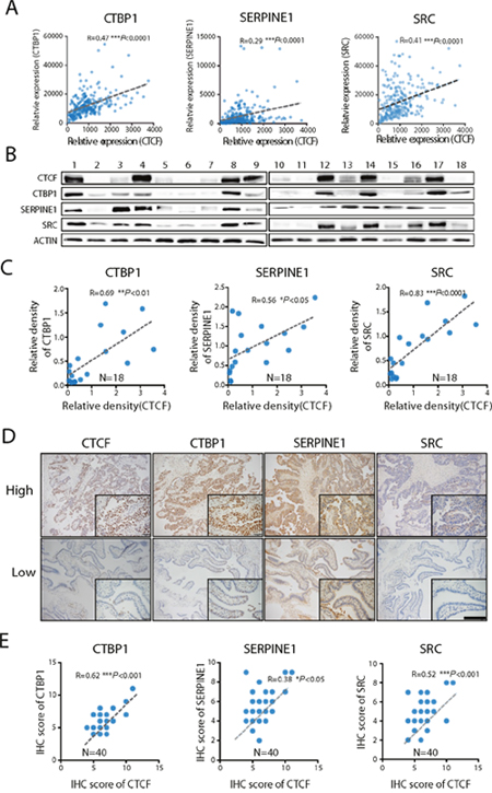 CTCF expression is directly correlated with CTBP1, SERPINE1 and SRC expression.