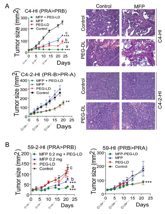 MFP improves the therapeutic effects of PEG-LD only in mammary carcinomas showing higher levels of PRA than PRB.