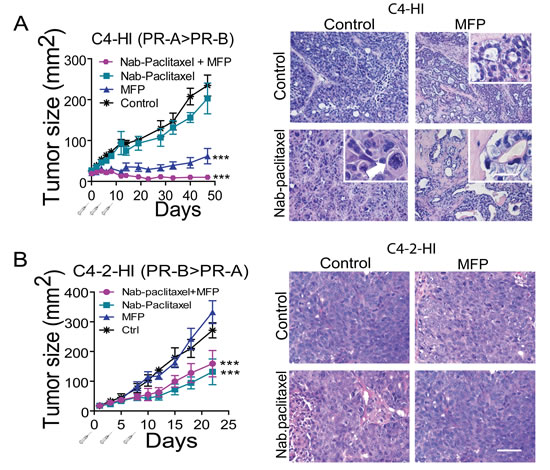 MFP improves the therapeutic effects of Nab-paclitaxel only in mammary carcinomas showing higher levels of PRA than PRB.