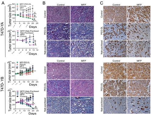 MFP improves the therapeutic effects of PEG-LD and Nab-paclitaxel only in xenografts overexpressing PRA.