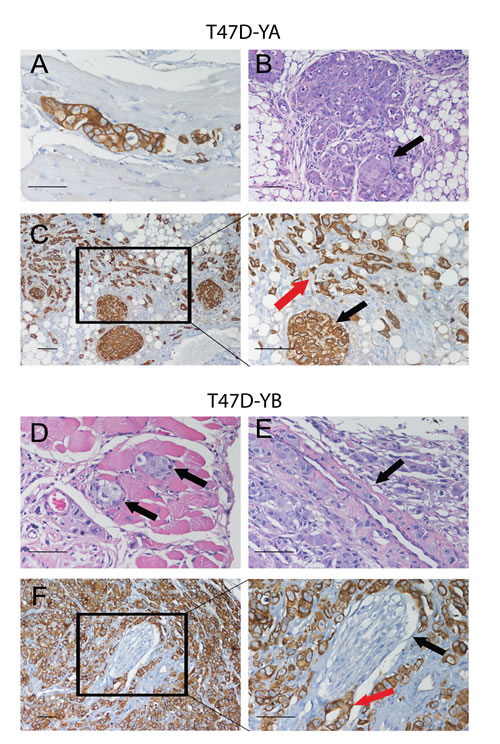 Images of T47D-YA and T47D-YB cells growing in vessels, muscle or nerve fibers, or inside the mammary gland ducts.