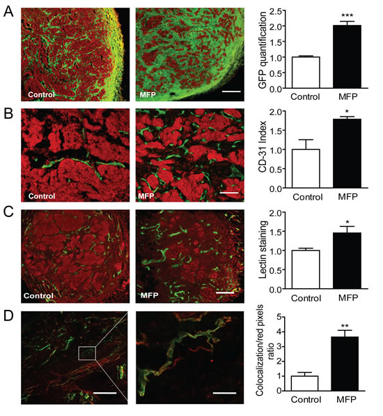 MFP treatment increased tumor remodeling and the amount of functional vessels in mammary carcinomas showing higher levels of PRA than PRB.