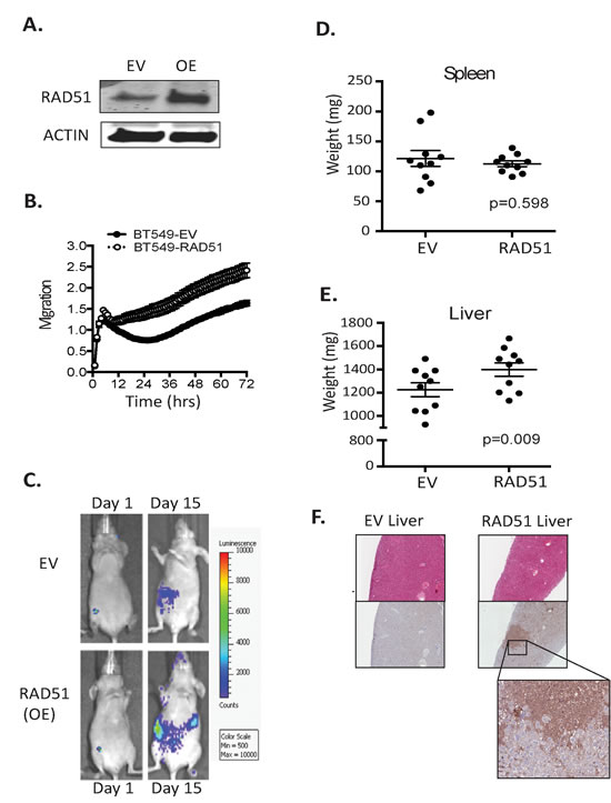 RAD51 can transform poorly metastatic cells.