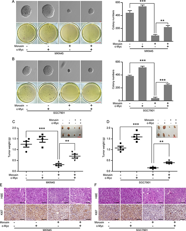 Morusin inhibits tumor growth by down-regulating c-Myc expression in vitro and in vivo.