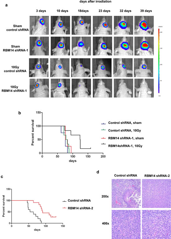 Effects of RBM14 knockdown on GBM tumor growth and mouse survival.