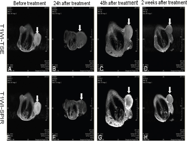 MRI of xenograft tumors at various times after therapy.
