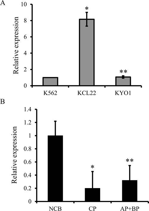 Real-time quantitative PCR assessment of the relative BCL2 mRNA expression levels in CML cell lines and primary progenitors.