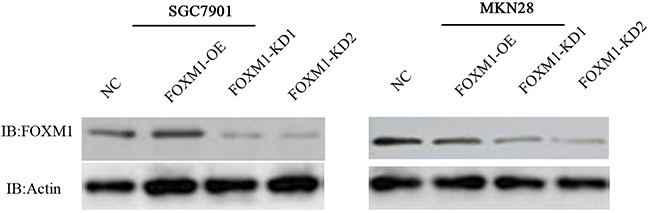 Knockdown and overexpression of FOXM1 in gastric cancer SGC7901 and MKN28 cell lines.