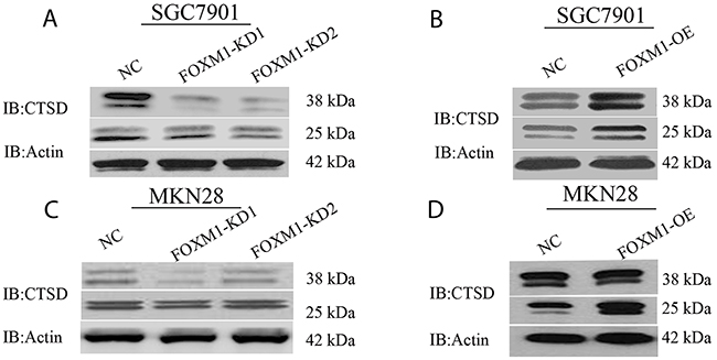 Cath-D expression in FOXM1 knockdown or overexpressing SGC7901 and MKN28 cells.