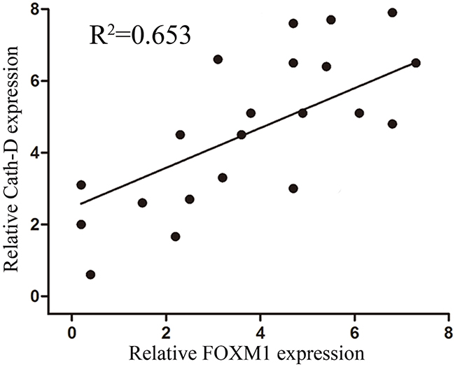 Expression of FOXM1 and Cath-D in gastric cancer tissues and their correlations.