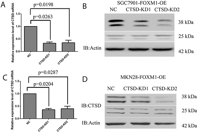 Knockdown of Cath-D in gastric cancer SGC7901 and MKN28 cells.