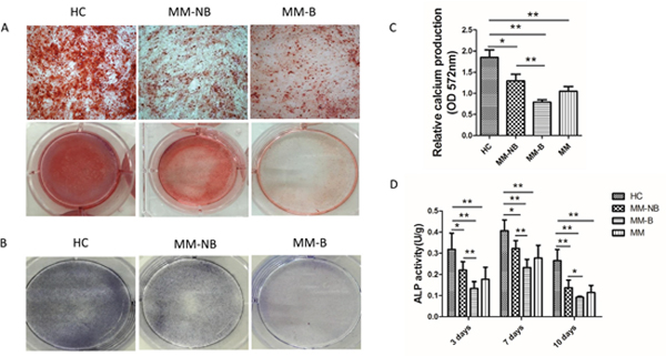 Decreased osteogenic differentiation of MM-MSCs.