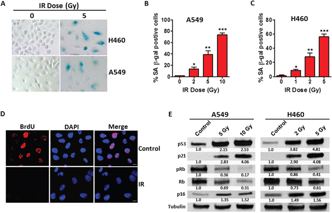 IR induces premature senescence in human NSCLC cells.