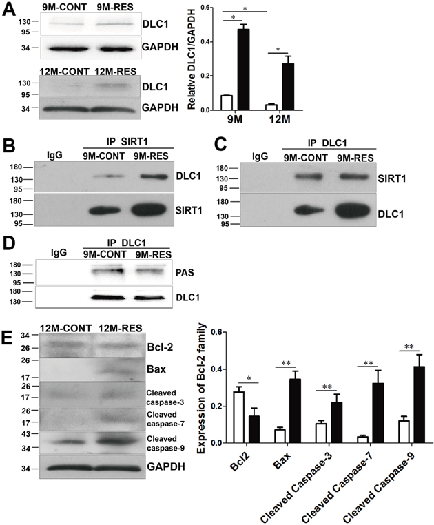 Resveratrol induced apoptosis by up-regulation of DLC1 and interaction between DLC1 and SIRT1, and dephosphorylation of DLC1 with SIRT1 up-regulation.