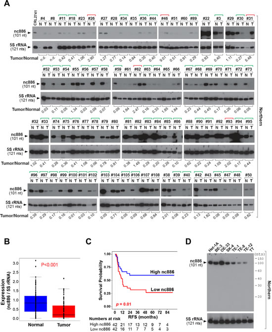 nc886 expression suppression in clinical specimens from ESCC patients and esophageal cell lines.