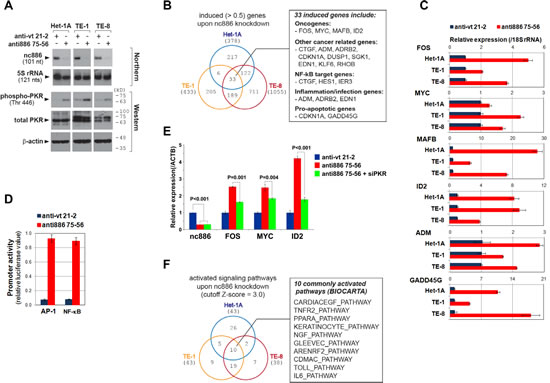 Gene expression profile and pathway analysis after nc886 knockdown.