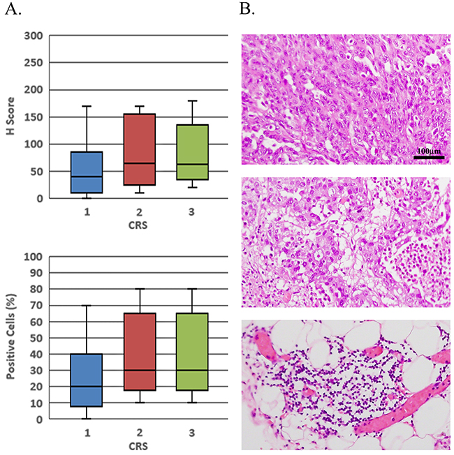 Pre-NACT CCNE1 expression does not correlate with pathological response to chemotherapy.