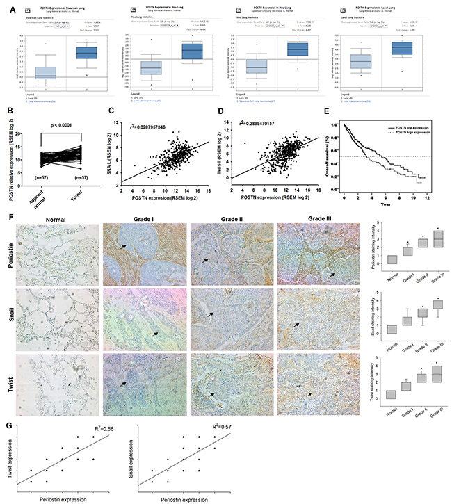 Periostin expression level and its prognostic value in lung cancer specimens.