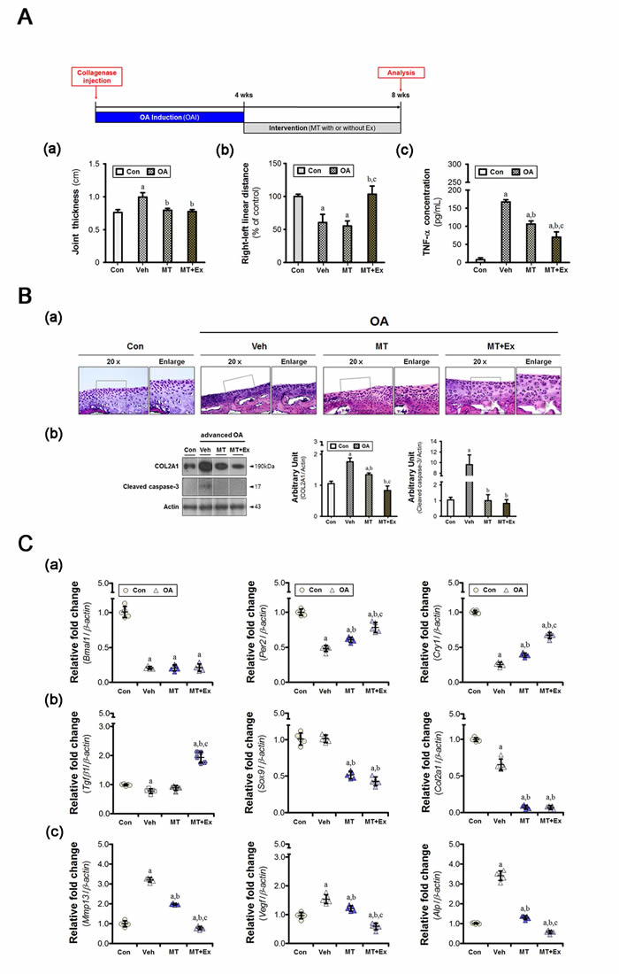 Melatonin combined with exercise restores metabolic balance in osteoarthritic cartilage.