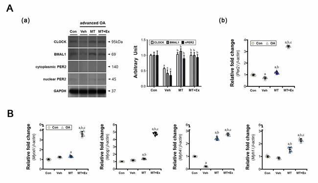 The preventive effects of melatonin with or without exercise on indirect muscular damage.