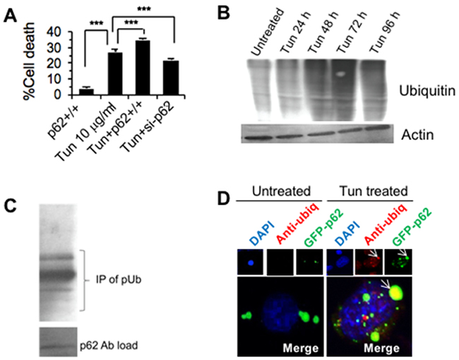 p62 accumulation facilitates aggregation of ubiquitinylated protein and ROS induced cell death.