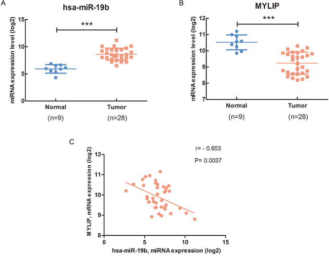 The expression of miR-19b is negatively correlated with MYLIP expression in breast cancer patient samples.