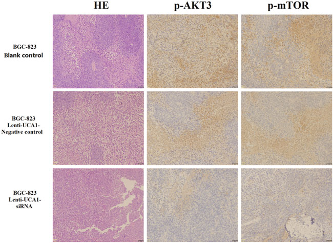Immunohistochemical technique analysis the tumor tissue proteins expression levels of p-AKT3 and p-mTOR in vivo of nude mice.