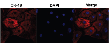 Endometrial epithelial cell culture and identification.