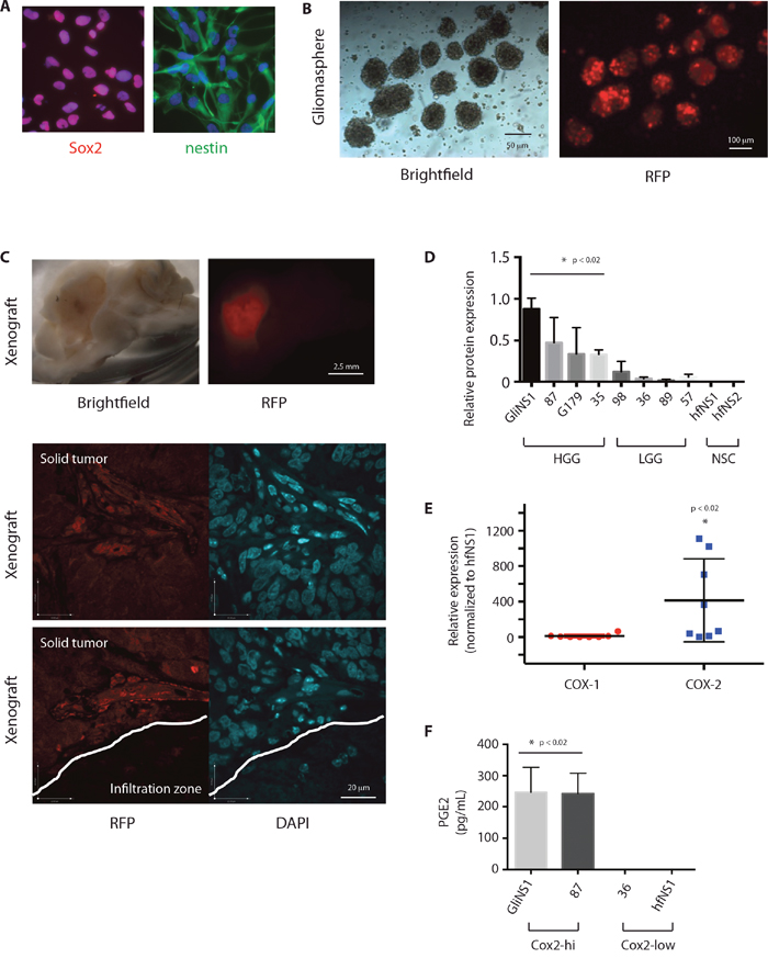 Cox-2 is enriched in GSCs and results in production of PGE2.