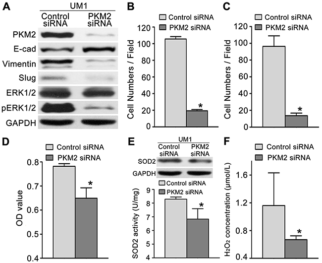 PKM2 knockdown inhibits TSCC cell migration and invasion.