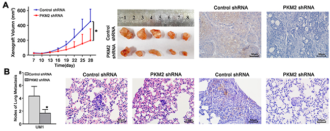 PKM2 knockdown inhibits TSCC xenograft growth and lung metastasis in vivo.