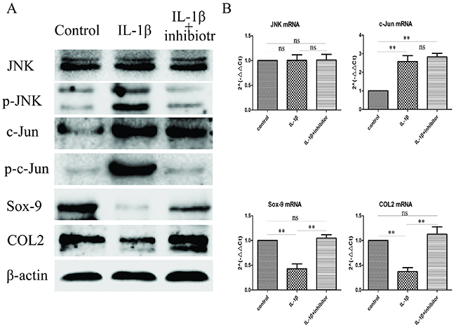 Inhibit JNK/c-Jun signaling pathway increase Sox-9 and COL2 expression.