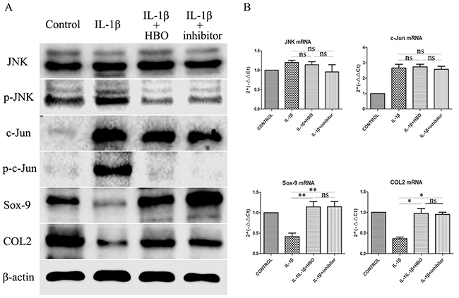 Western blot and RT-qRCR showed the change in expression of JNK/c-Jun signaling pathway, Sox-9 and COL2.