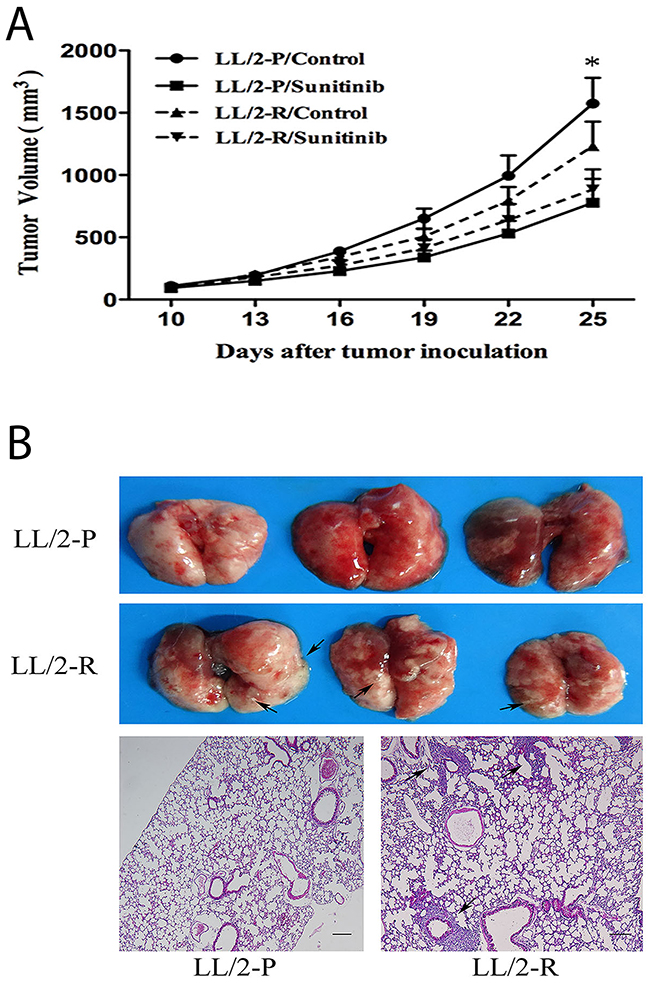 Decreased growth-inhibitory effect of sunitinib and enhanced metastatic potential of LL/2-R cell subline in vivo.