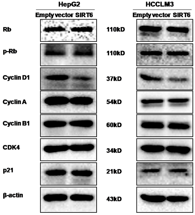 Effects of SIRT6 overexpression on the expression of cell cycle-related proteins.