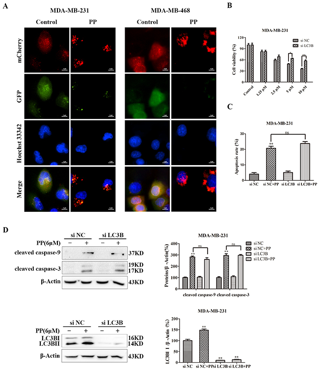 PP induced autophagic cell growth inhibition in triple-negative breast cancer cells.