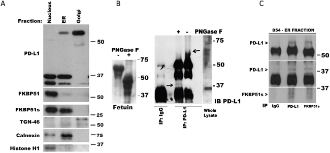FKBP51s is associated with PD-L1 in ER.