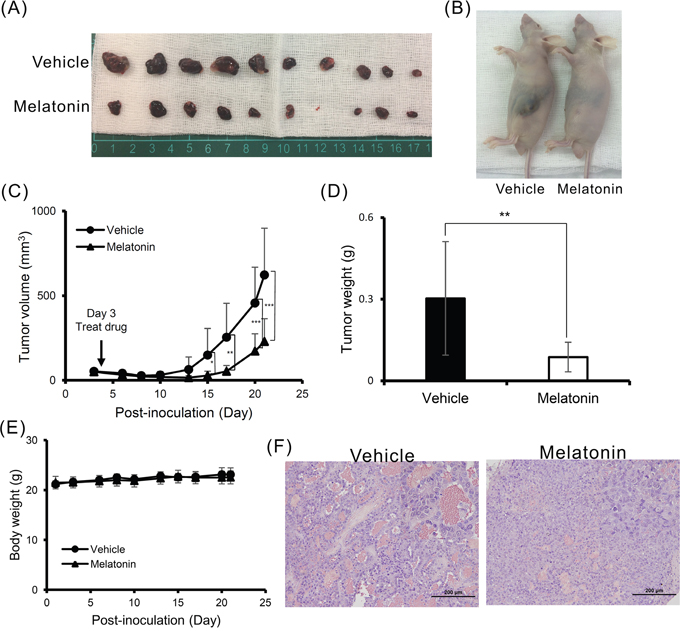 Melatonin suppressed tumor growth in vivo.