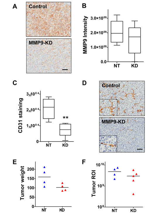 MMP9 silencing inhibits vessel formation and modestly suppresses tumor growth.