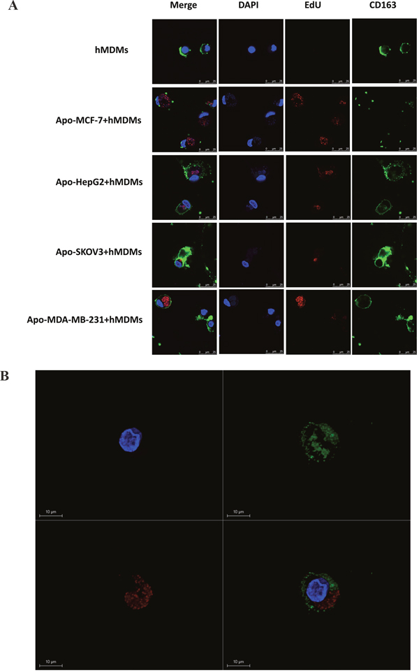 Confocal microscopy analysis and 3D reconstruction of CD163 and EdU expression in hMDMs co-cultured with different apoptotic tumor cells.