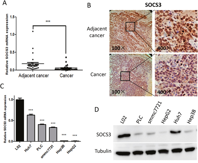 The expression of SOCS3 is down-regulated in HCC tissues and cells.