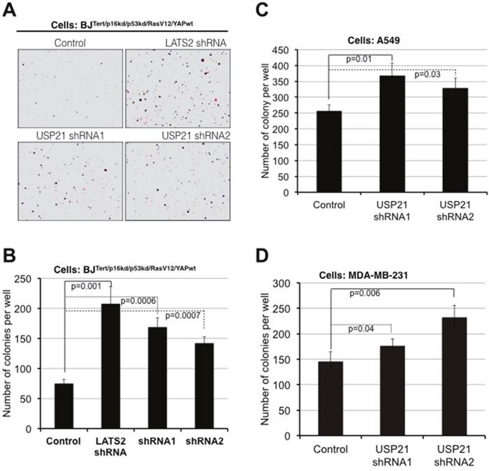 USP21 inhibition promotes oncogenic transformation in BJ and cancer cell lines.