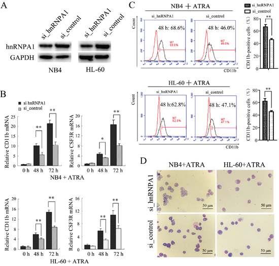 The knockdown of hnRNP A1 promotes the ATRA-induced granulocyte differentiation of NB4 and HL-60 cells.