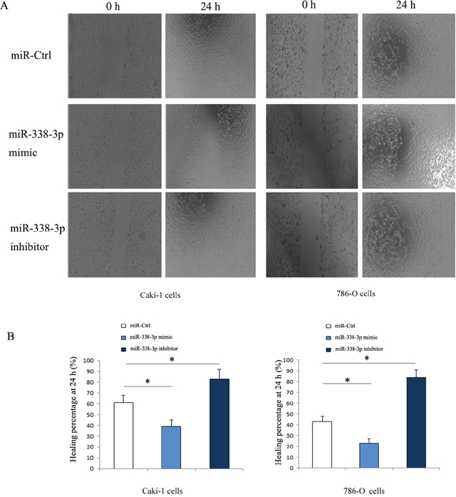 Migration of RCC cells transfected with miR-338-3p mimic or inhibitor detected by wound healing assay.